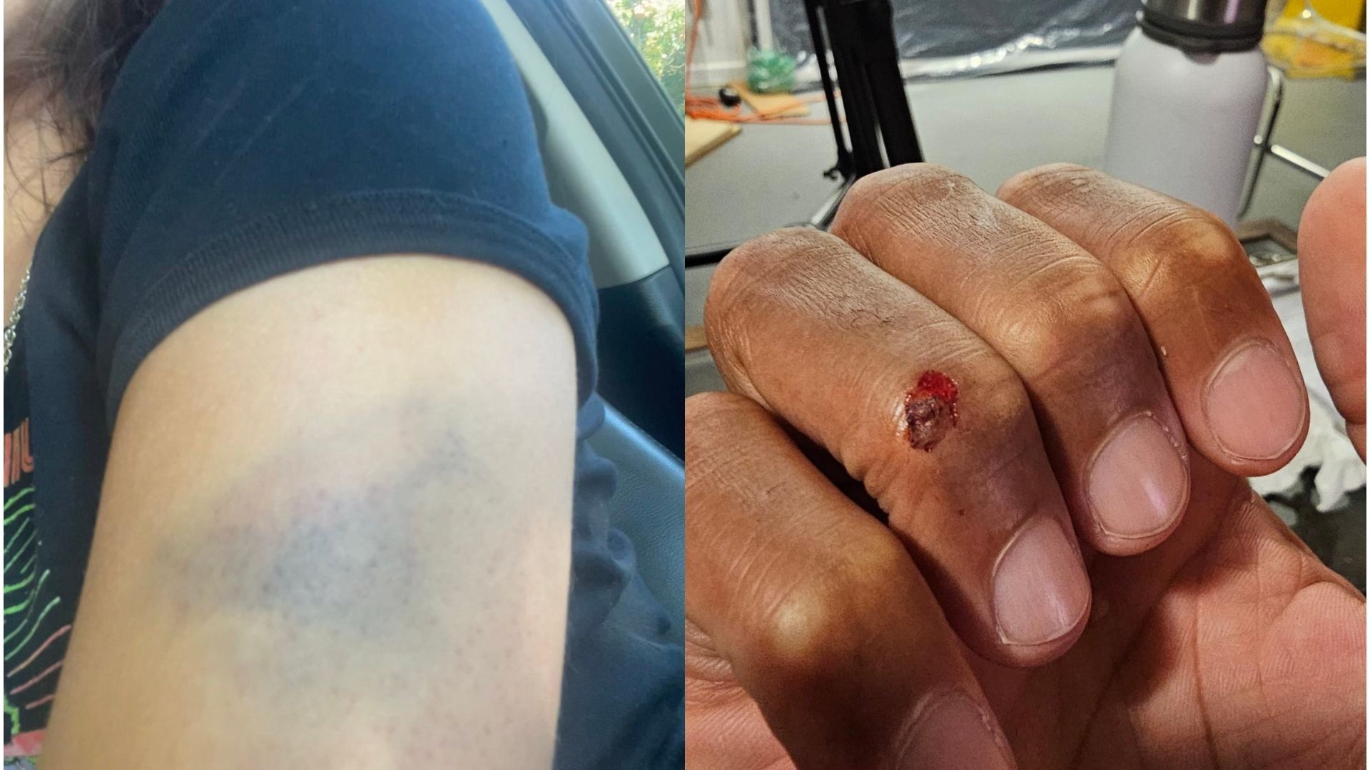 Injuries LAPD